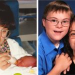 Couple with Down syndrome decide to have children, face criticism