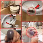 People in different areas were attacked while using the bathroom…