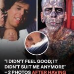 A Man Once Known for Having the Most Tattoos in Brazil Reveals His Shocking Transformation After Removing Them — The AFTER Photos